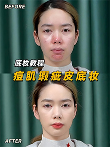 化妝教程 | 痘痘肌瑕疵皮也能擁有磨皮底妝 化妝教程 | 痘痘肌瑕疵皮也能擁有磨皮底妝